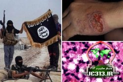  شیوع نوعی بیماری مرگبار در میان داعشی‌ها